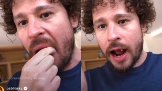 El youtuber Luisito Comunica perdió dos dientes durante una transmisión en vivo