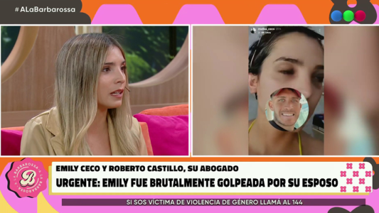 Emily fue brutalmente golpeada por su esposo Santiago Martínez