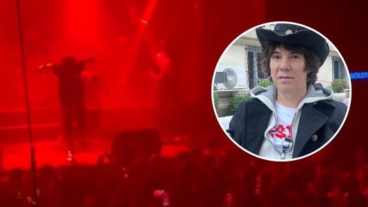 Maxi Trusso contó cómo se recupera tras al arrojarse al público y sufrir un grave accidente