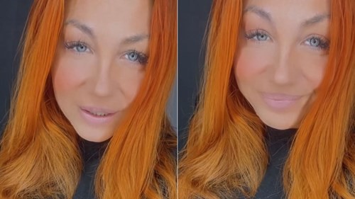 Lowrdez Fernández: en qué consiste la histerectomía, la cirugía que debió afrontar